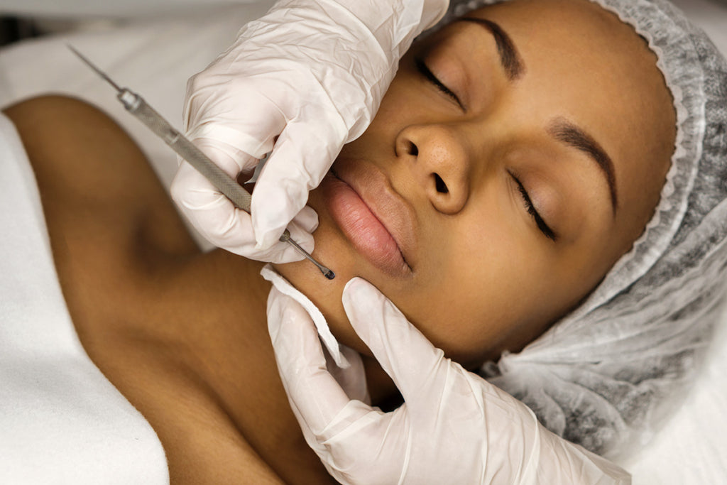 Skin Extractions