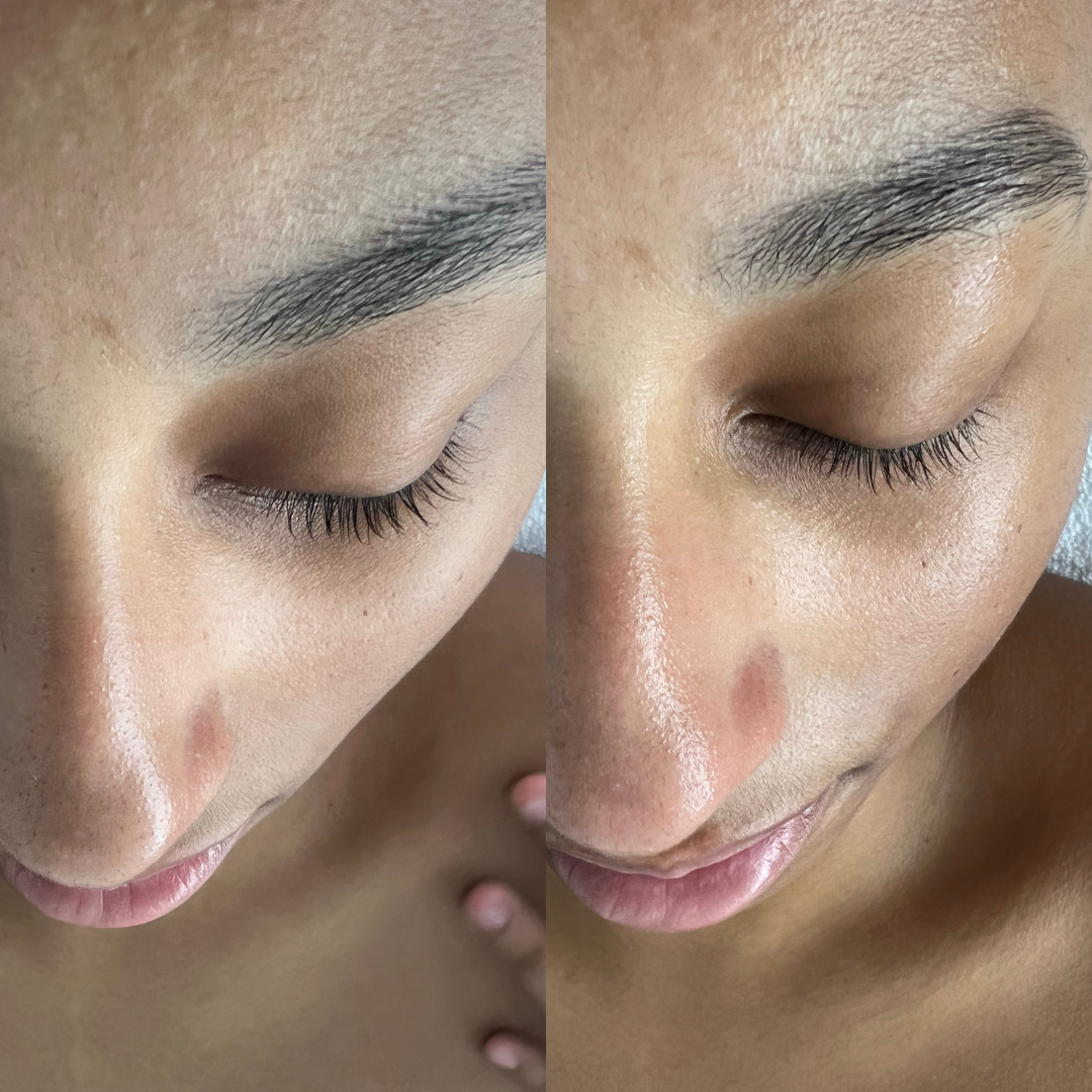 Signature Chariibomb Facial